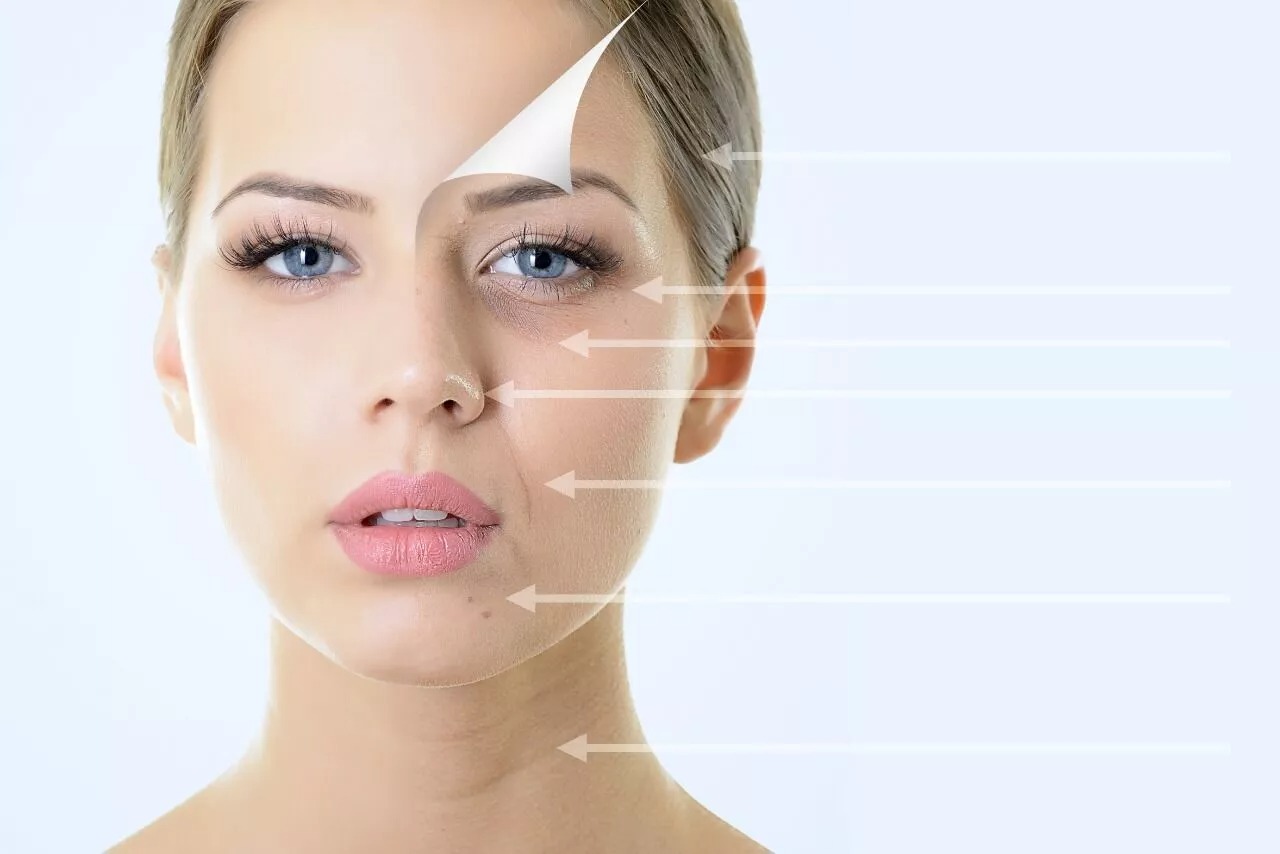 4 Reasons Why Botox Treatment is More Effective than Surgery